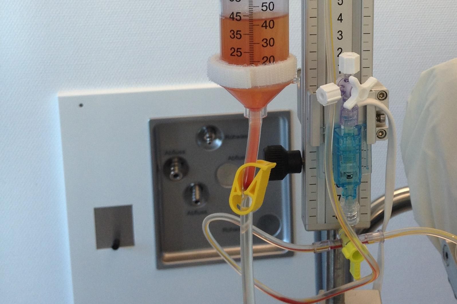 Mit der Liquordiagnostik können zum Beispiel entzündliche Prozesse im Gehirn nachgewiesen werden. 