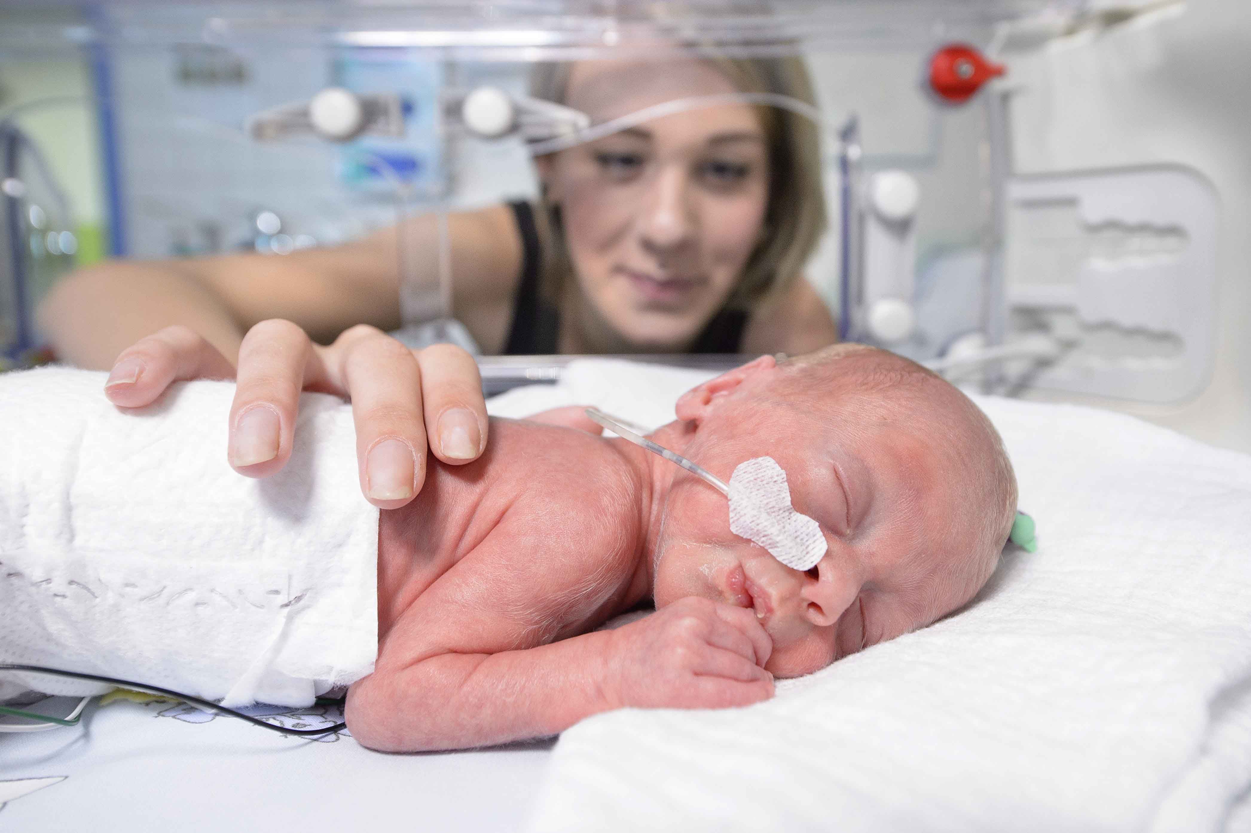 Frühgeborenes Kind mit Magensonde im Inkubator auf der Kinderintensivstation KIS 20 im Klinikum Saarbrücken. 