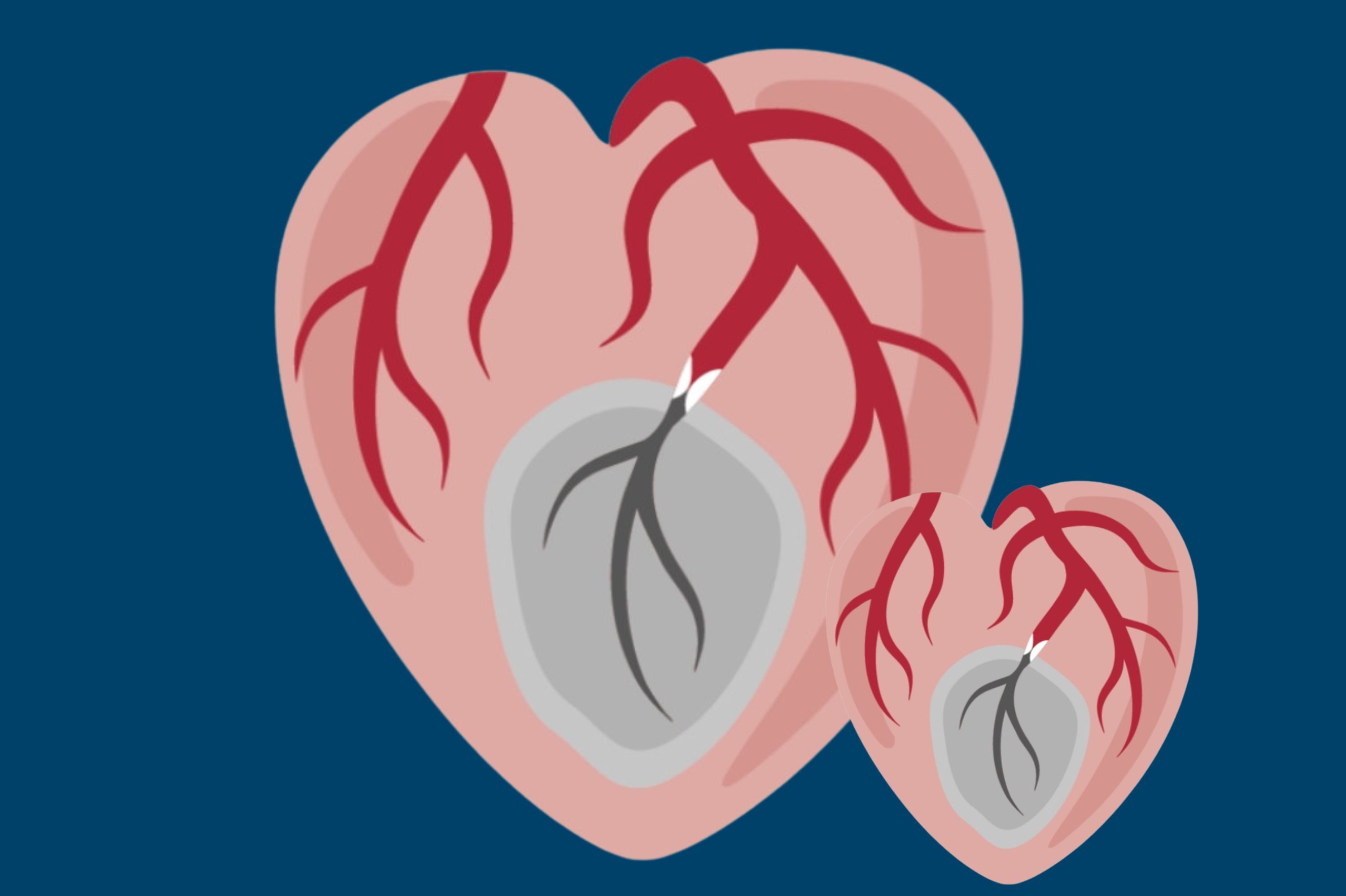 Symbolfoto für den Herztag 2025