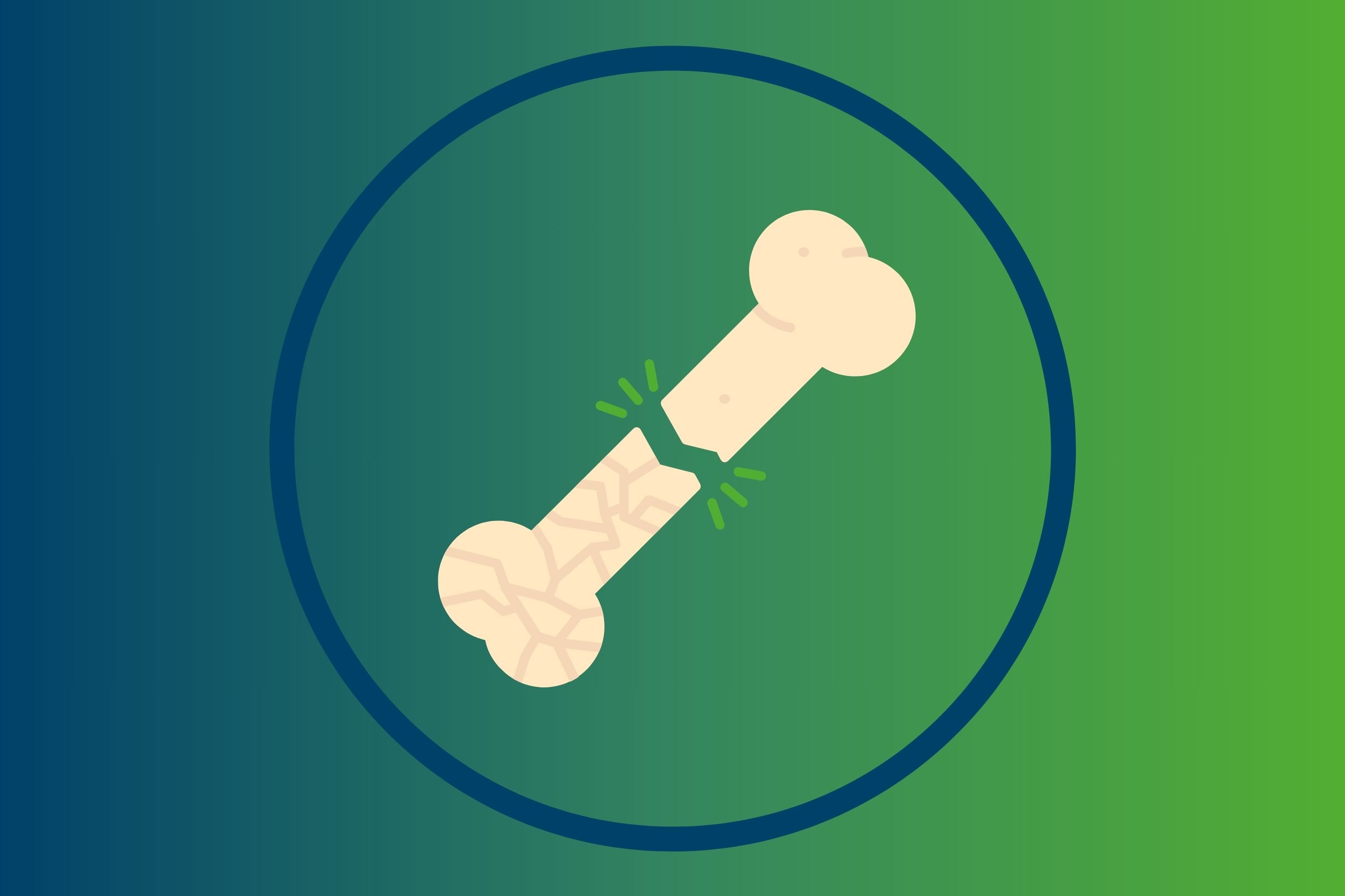 Ein durch Osteoporose gebrochener Knochen. 