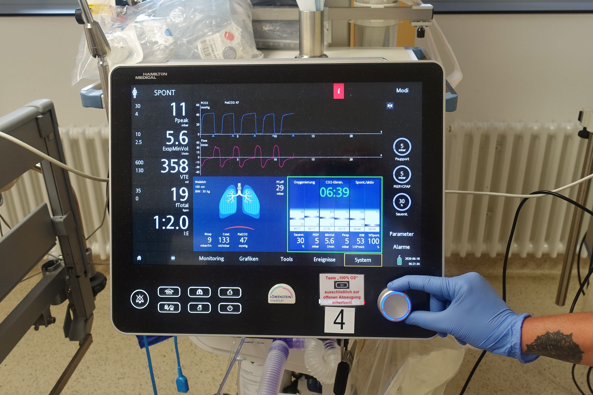 Beatmungsgerät auf der Intensivstation im Klinikum Saarbrücken 