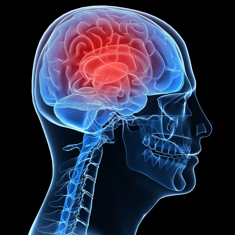 Symbolbild: Schädel mit dargestelltem Gehirn für das Neurovaskuläre Zentrum im Klinikum Saarbrücken