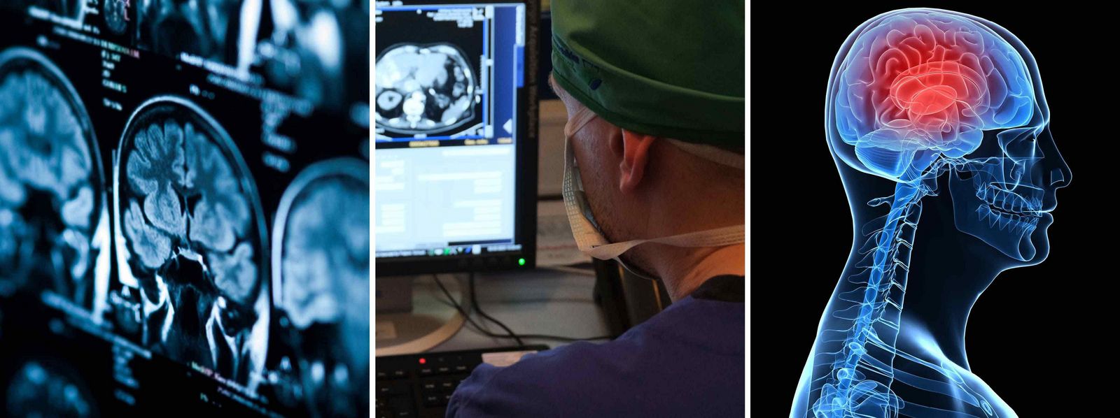 Drei Fotos von Röntgenaufnahmen des Hirns Slider_NVZ.jpg