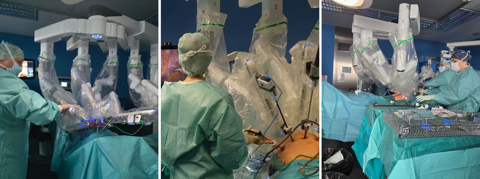 Collage aus drei Bildern: 1. Ein Arzt justiert die Arme am DaVinci-Roboter während einer Operation nach; 2. eine Ärztin entfernt aus dem Bauchraum Gewebe mit dem DaVinci-Roboter und blickt auf einen Monitor; 3. Blick auf den Operationstisch sowie das Operationsbesteck, das eine OTA richtet, während einer DaVinci-Operation DaVinci_interdisziplinaeres_Operieren_Slider.jpg