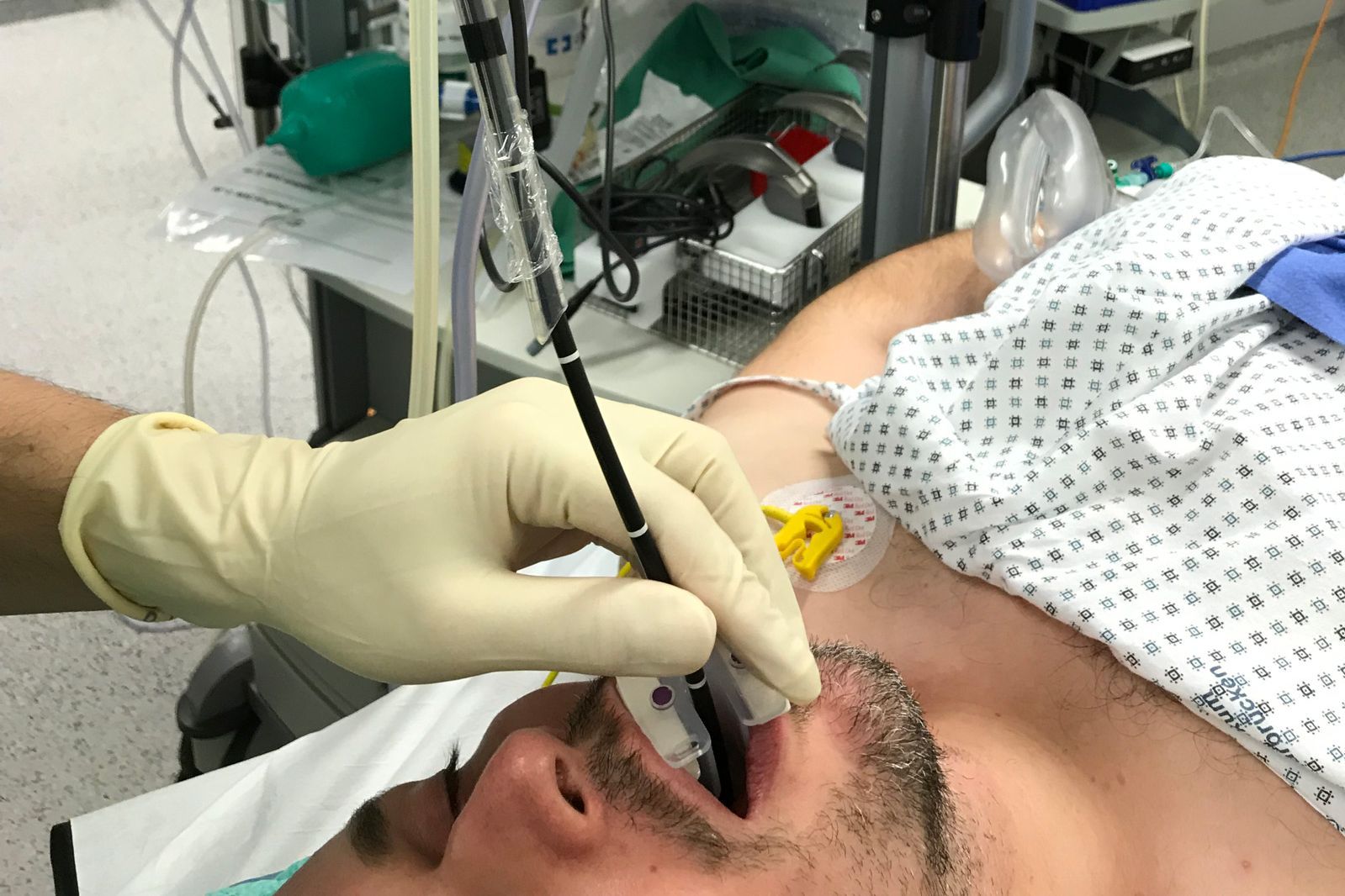Unter Bronchoskopie versteht man eine Lungenspiegelung. Die Bronchoskopie kann helfen, einige Krankheitszustände der Luftwege (Bronchien) und der Lunge zu diagnostizieren und zu behandeln. 