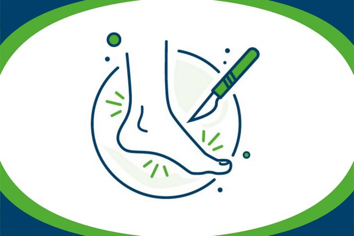 Grafik zur Veranstaltung: Abbildung eines Fußes sowie eines Skalpells