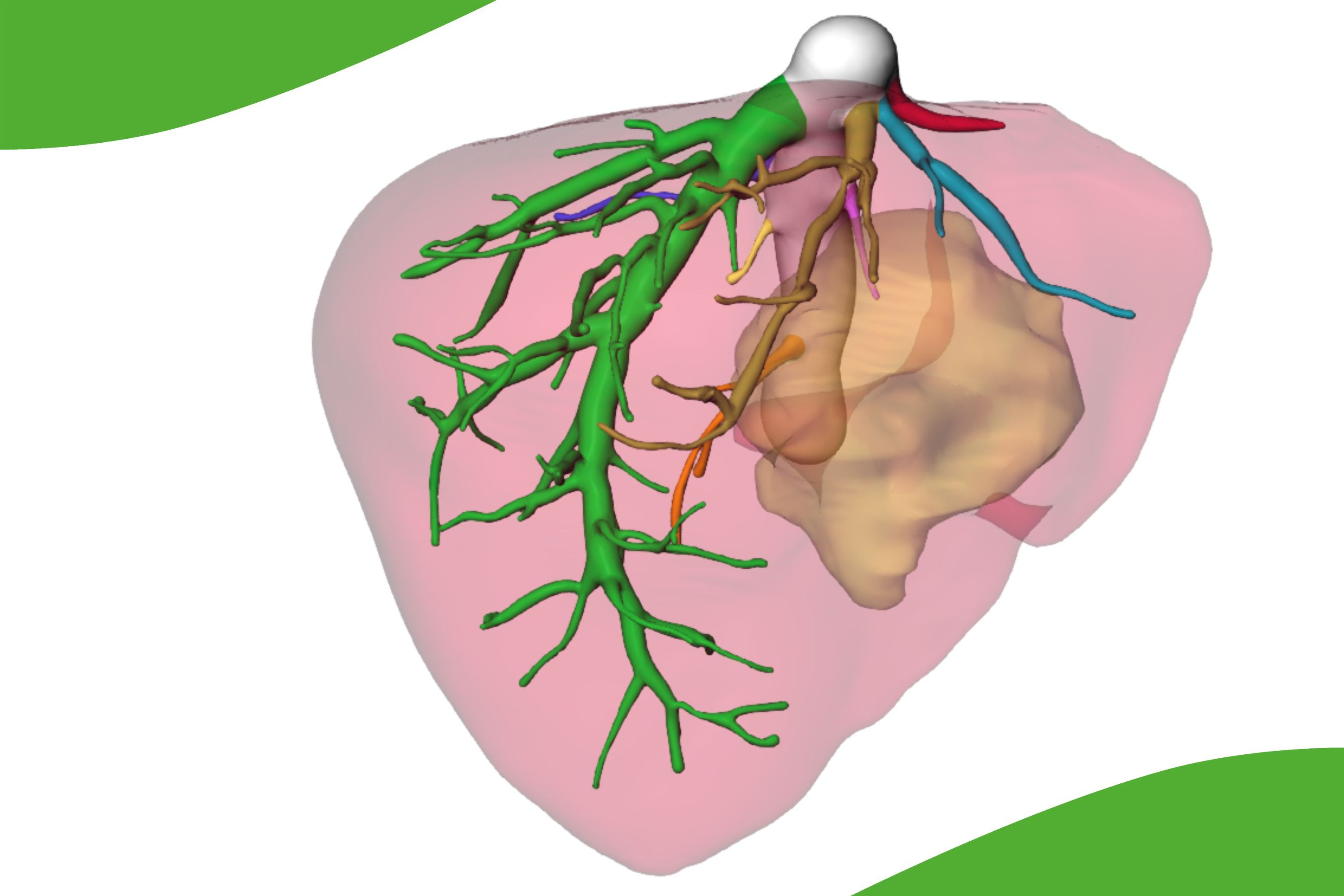 Farbliche 3D-Darstellung einer Leber, die rosa dargestellt ist. Die Gallenwege zeigen sich in grün, die Blutgefäße in rot.