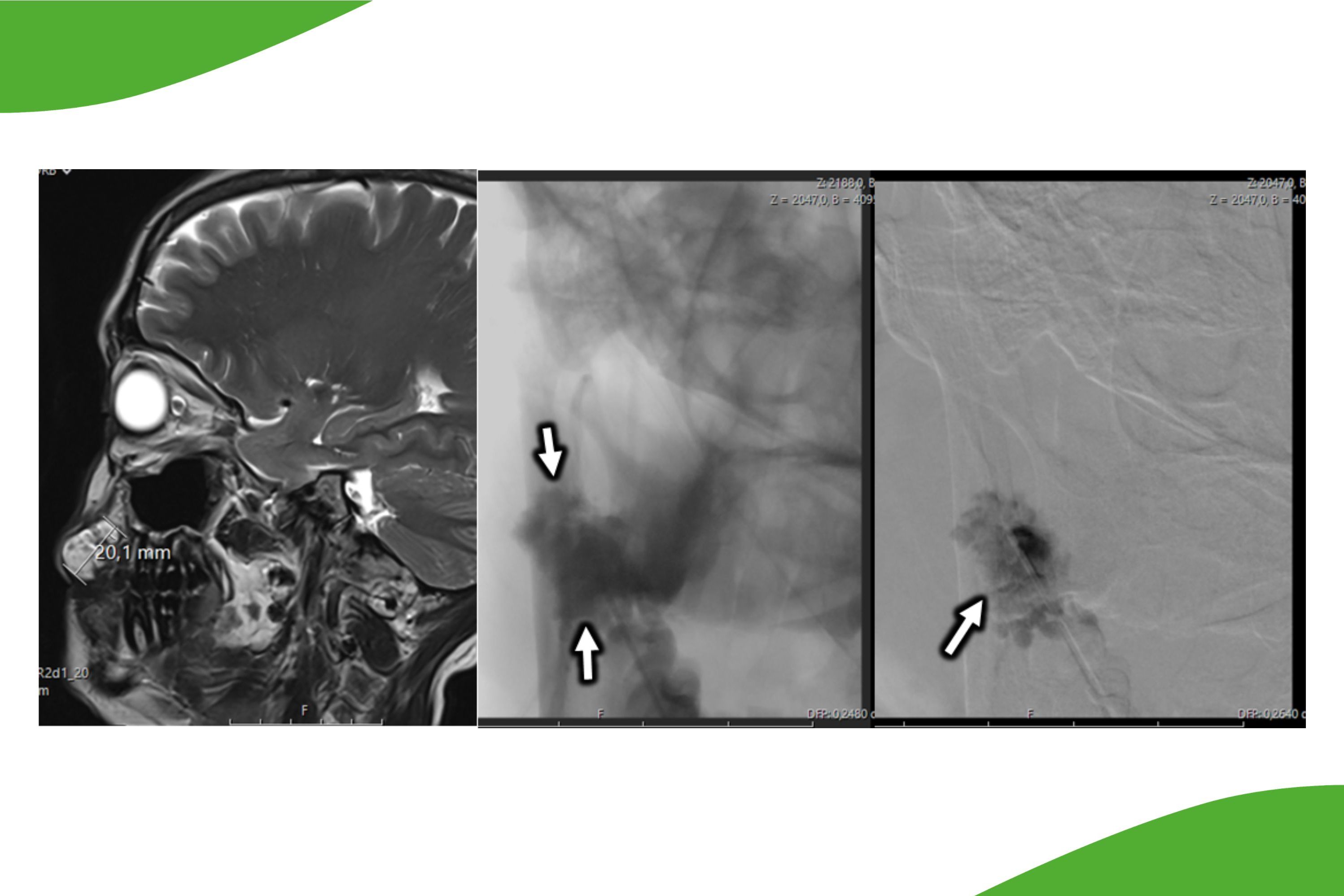 Grafische Darstellung der BEST-Methode in drei Abschnitten 