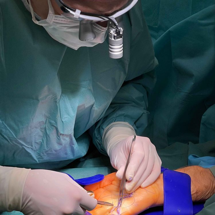 Blick in den OP während einer Operation an der Hand mit Morbus Dupuytren