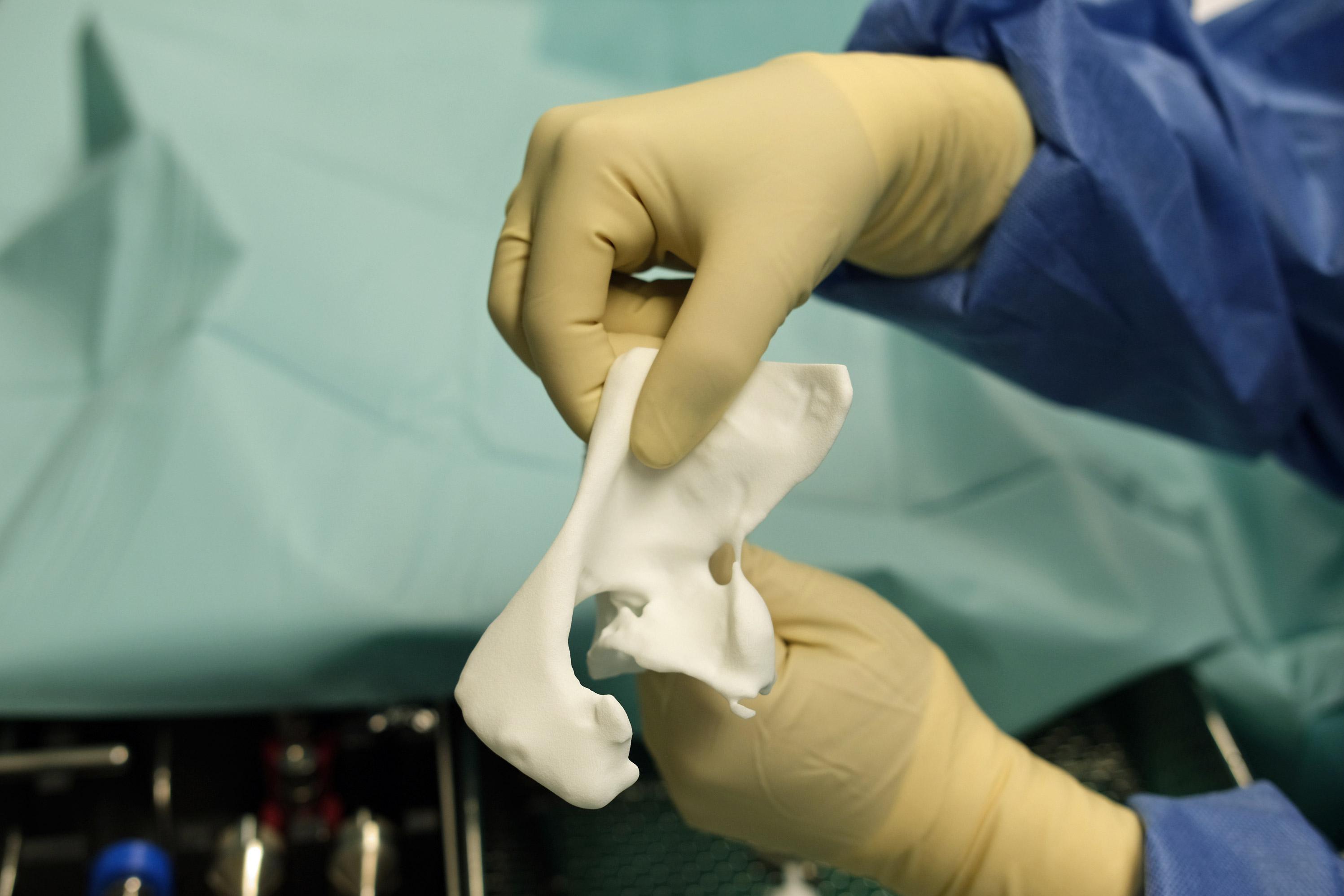 Im Operationssaal im Klinikum Saarbrücken: Künstlicher Gelenkersatz in den Händen