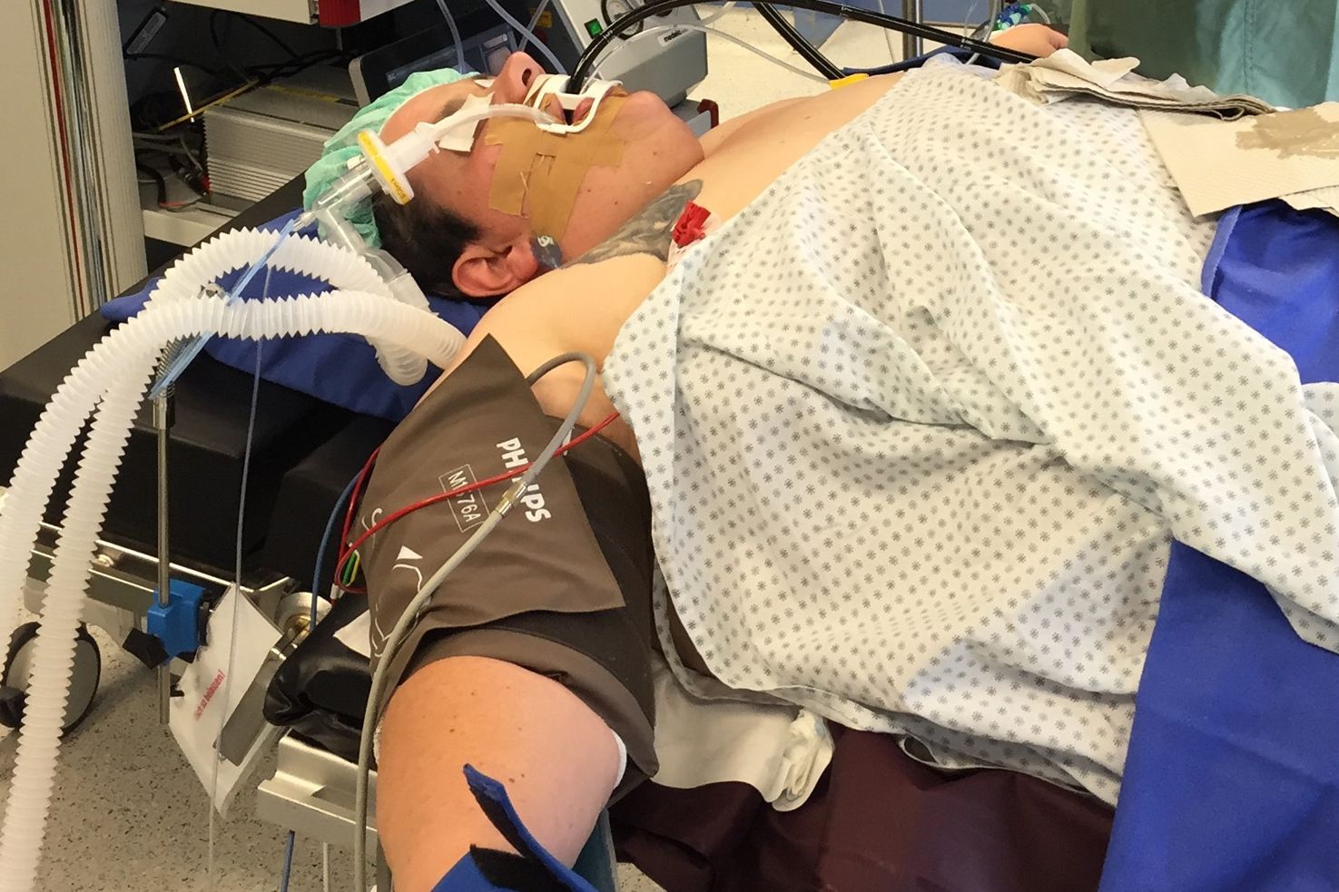 Bei der Endoskopie werden entweder die Speiseröhre, der Magen und der Zwölffingerdarm (Oesophago-Gastro-Duodoenoskopie), also der obere Gastrointestinaltrakt untersucht oder die Endoskopie erfolgt als Koloskopie, also eine Spiegelung des unteren Gastrointestinaltraktes.





