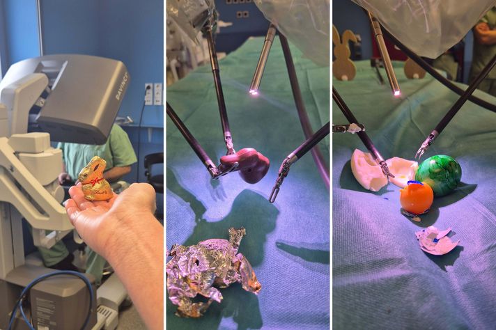 Collage: Foto 1 mit Lindt-Osterhase auf einer Hand vor DaVinci-Operateur, Foto 2 - ausgepackter Schokoosterhase der mit DaVinci-Werkzeugen gehalten wird, Foto 3 ein mit Hilfe des Robotersystems auseinander geteiltes Osterei