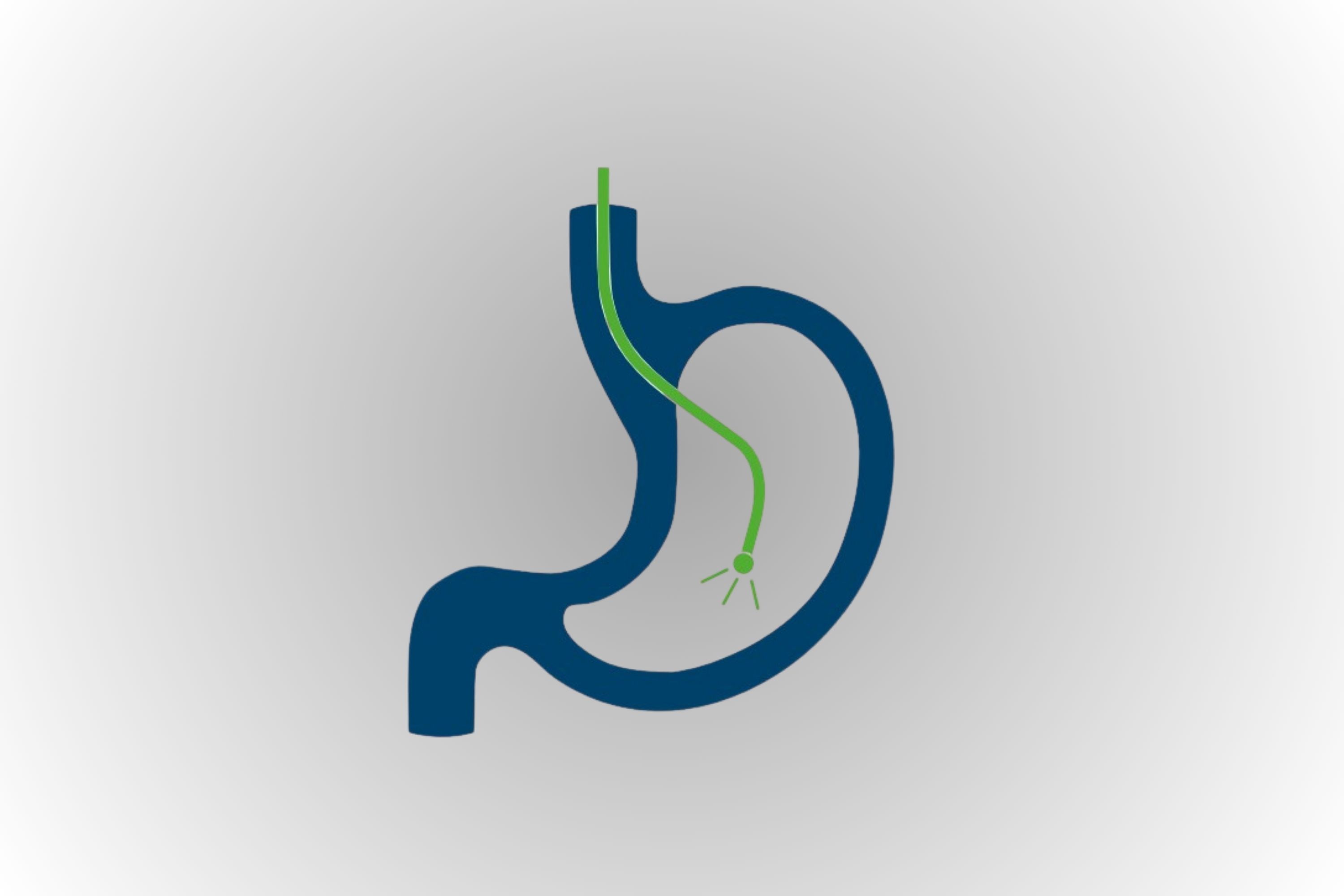 Icon: Endoskop im Magen